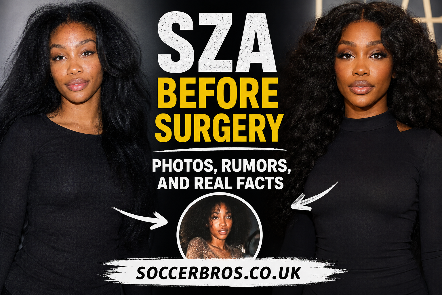 SZA Before Surgery